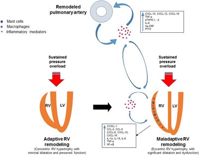 Inflammatory Mediators Drive Adverse Right Ventricular Remodeling and Dysfunction and Serve as Potential Biomarkers